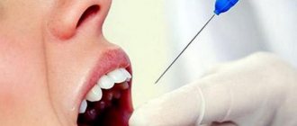 Анестезия при удалении зуба