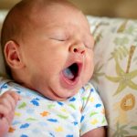 Black tongue in a one-year-old child