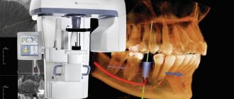 Before and after computed tomography