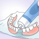 фиксация зубных протезов при полном отсутствии зубов