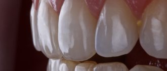 photo of teeth for photo protocol