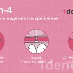 Имплантация all-on-4