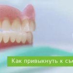 how to quickly get used to removable dentures