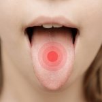 How to get rid of tongue pain?