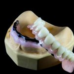 Clasps with dentures