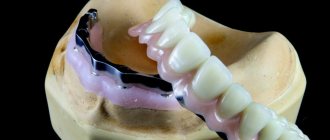 Clasps with dentures