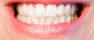 When is molar tooth extraction indicated?