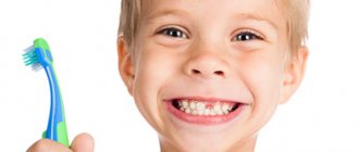 Treatment of caries in children