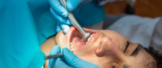 лечение зубов под наркозом рис 3