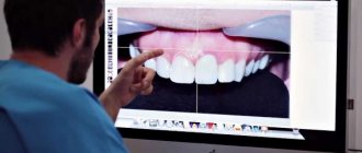 Techniques used for smile design