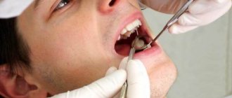 Методы диагностики некроза зубов