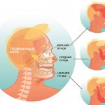 Лицевой двусторонней прозопалгии лица. Прозопалгия левосторонняя прозопалгия. Лицевые боли. Прозопалгия лица фото.