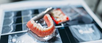 Orthodontist and orthopedist in dentistry: what is common and what is the difference?