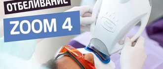 Teeth whitening ZOOM 4 in Moscow - German dentistry