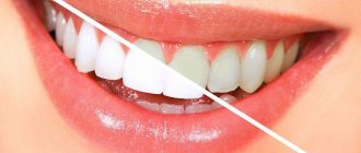 whitening strips crest 3d white reviews