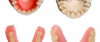 Advantages of acrylic dentures