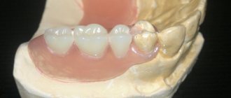 Pros and cons of Flexite dentures