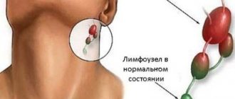 Submandibular lymph node in normal and inflamed state