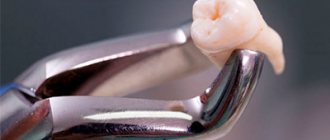показания и противопоказания к удалению зуба фото