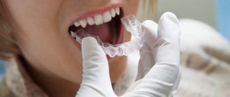 Advantages of the material - Dentistry &quot;Smile Line&quot;