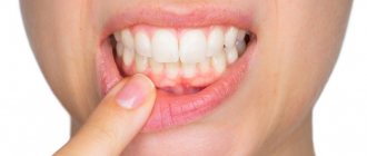 Causes of pain under the gum when pressing