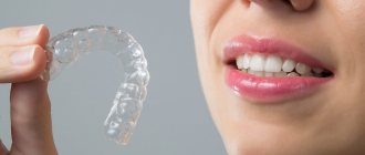 Clear aligners