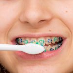 Brush for braces