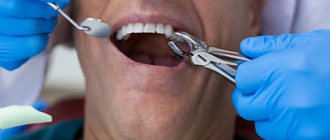 Сколько болит зуб после удаления нерва - Стоматология «Линия Улыбки