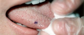 Tongue injury can cause itching