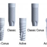 Types of implants