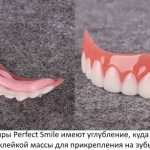 Виниры Перфект Смайл (Perfect Smile Veneers). Отзывы реальные, инструкция, как установить