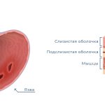 Воспаленная язва и схема поперечного сечения слизистой оболочки желудка