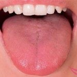 healthy tongue