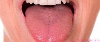 healthy tongue