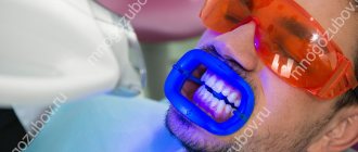 Zoom - отбеливание зубов