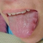 Зубчатый язык